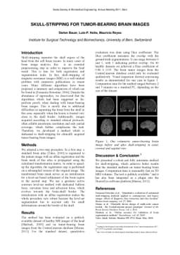 Skull-stripping for Tumor-bearing Brain Images