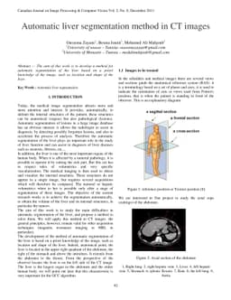 Automatic liver segmentation method in CT images