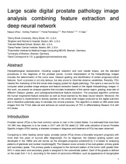 Large scale digital prostate pathology image analysis combining feature
  extraction and deep neural network