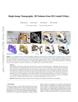 Single-image Tomography: 3D Volumes from 2D Cranial X-Rays
