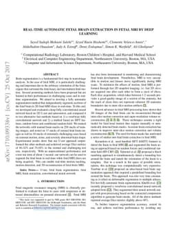 Real-Time Automatic Fetal Brain Extraction in Fetal MRI by Deep Learning