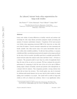 Almost instant brain atlas segmentation for large-scale studies