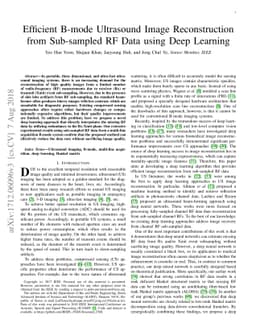 Efficient B-mode Ultrasound Image Reconstruction from Sub-sampled RF
  Data using Deep Learning