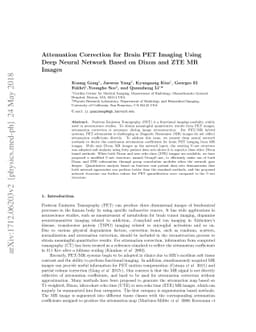 Attenuation correction for brain PET imaging using deep neural network
  based on dixon and ZTE MR images