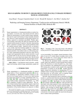Self-Learning to Detect and Segment Cysts in Lung CT Images without
  Manual Annotation