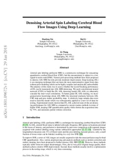 Denoising Arterial Spin Labeling Cerebral Blood Flow Images Using Deep
  Learning