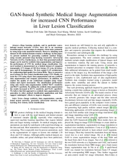 GAN-based Synthetic Medical Image Augmentation for increased CNN
  Performance in Liver Lesion Classification