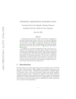 Automatic segmentation of prostate zones