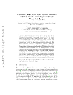 Reinforced Auto-Zoom Net: Towards Accurate and Fast Breast Cancer
  Segmentation in Whole-slide Images