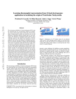 Learning disentangled representation from 12-lead electrograms:
  application in localizing the origin of Ventricular Tachycardia