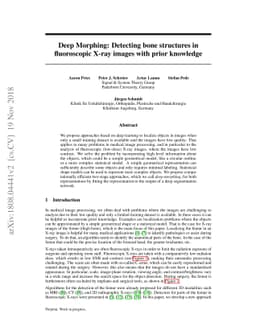 Deep Morphing: Detecting bone structures in fluoroscopic X-ray images
  with prior knowledge