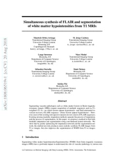 Simultaneous synthesis of FLAIR and segmentation of white matter
  hypointensities from T1 MRIs