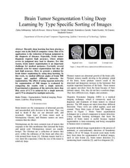 Brain Tumor Segmentation Using Deep Learning by Type Specific Sorting of
  Images