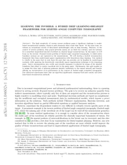 Learning The Invisible: A Hybrid Deep Learning-Shearlet Framework for
  Limited Angle Computed Tomography