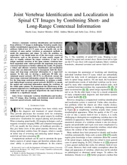 Joint Vertebrae Identification and Localization in Spinal CT Images by
  Combining Short- and Long-Range Contextual Information