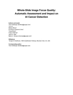 Whole-Slide Image Focus Quality: Automatic Assessment and Impact on AI
  Cancer Detection
