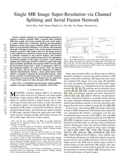 Single MR Image Super-Resolution via Channel Splitting and Serial Fusion
  Network
