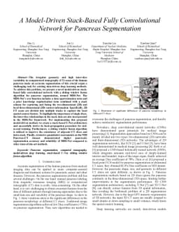 A Model-Driven Stack-Based Fully Convolutional Network for Pancreas
  Segmentation