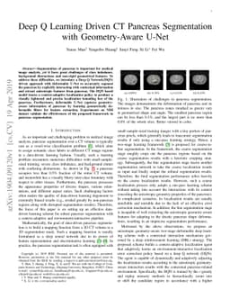 Deep Q Learning Driven CT Pancreas Segmentation with Geometry-Aware
  U-Net