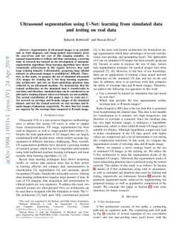 Ultrasound segmentation using U-Net: learning from simulated data and
  testing on real data