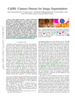 CaDIS: Cataract Dataset for Image Segmentation