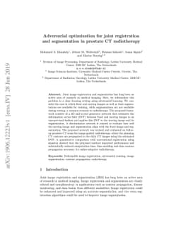 Adversarial optimization for joint registration and segmentation in
  prostate CT radiotherapy