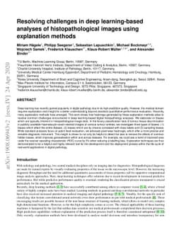 Resolving challenges in deep learning-based analyses of
  histopathological images using explanation methods