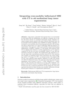 Integrating cross-modality hallucinated MRI with CT to aid mediastinal
  lung tumor segmentation