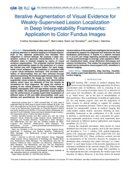 Iterative Augmentation of Visual Evidence for Weakly-Supervised Lesion
  Localization in Deep Interpretability Frameworks: Application to Color Fundus
  Images