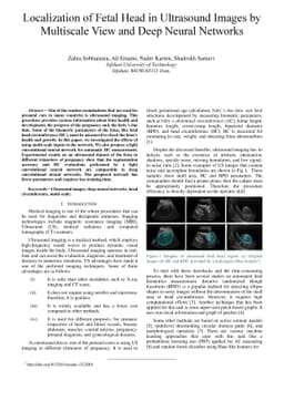 Localization of Fetal Head in Ultrasound Images by Multiscale View and
  Deep Neural Networks
