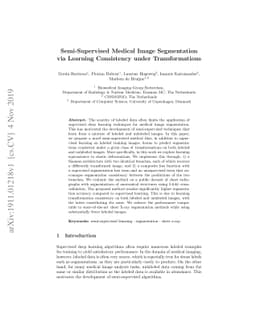 Semi-Supervised Medical Image Segmentation via Learning Consistency
  under Transformations