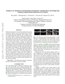 Sparse-GAN: Sparsity-constrained Generative Adversarial Network for
  Anomaly Detection in Retinal OCT Image