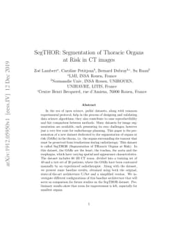 SegTHOR: Segmentation of Thoracic Organs at Risk in CT images