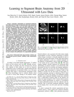 Learning to Segment Brain Anatomy from 2D Ultrasound with Less Data