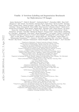 VerSe: A Vertebrae Labelling and Segmentation Benchmark for
  Multi-detector CT Images