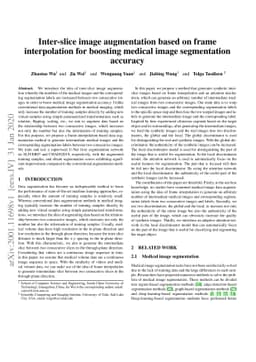 Inter-slice image augmentation based on frame interpolation for boosting
  medical image segmentation accuracy