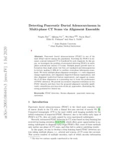 Detecting Pancreatic Ductal Adenocarcinoma in Multi-phase CT Scans via
  Alignment Ensemble