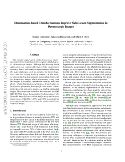 Illumination-based Transformations Improve Skin Lesion Segmentation in
  Dermoscopic Images