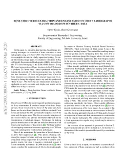 Bone Structures Extraction and Enhancement in Chest Radiographs via CNN
  Trained on Synthetic Data