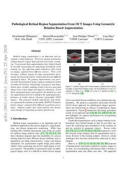 Pathological Retinal Region Segmentation From OCT Images Using Geometric
  Relation Based Augmentation