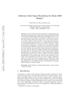 Arbitrary Scale Super-Resolution for Brain MRI Images
