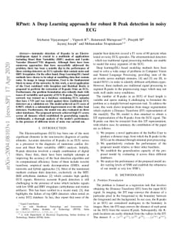 RPnet: A Deep Learning approach for robust R Peak detection in noisy ECG