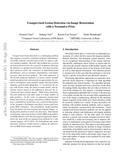 Unsupervised Lesion Detection via Image Restoration with a Normative
  Prior