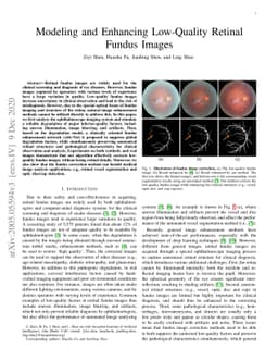 Modeling and Enhancing Low-quality Retinal Fundus Images