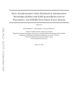 Data Augmentation using Generative Adversarial Networks (GANs) for
  GAN-based Detection of Pneumonia and COVID-19 in Chest X-ray Images