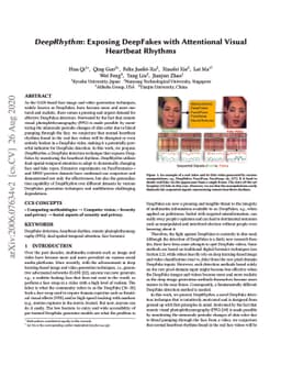 DeepRhythm: Exposing DeepFakes with Attentional Visual Heartbeat Rhythms