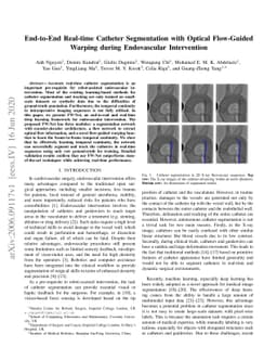 End-to-End Real-time Catheter Segmentation with Optical Flow-Guided
  Warping during Endovascular Intervention