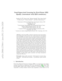 Semi-Supervised Learning for Fetal Brain MRI Quality Assessment with ROI
  consistency