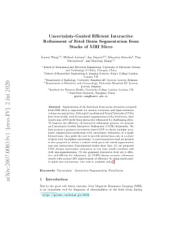 Uncertainty-Guided Efficient Interactive Refinement of Fetal Brain
  Segmentation from Stacks of MRI Slices