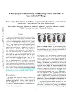 A Weakly Supervised Consistency-based Learning Method for COVID-19
  Segmentation in CT Images